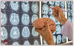 تخصص مغز و اعصاب