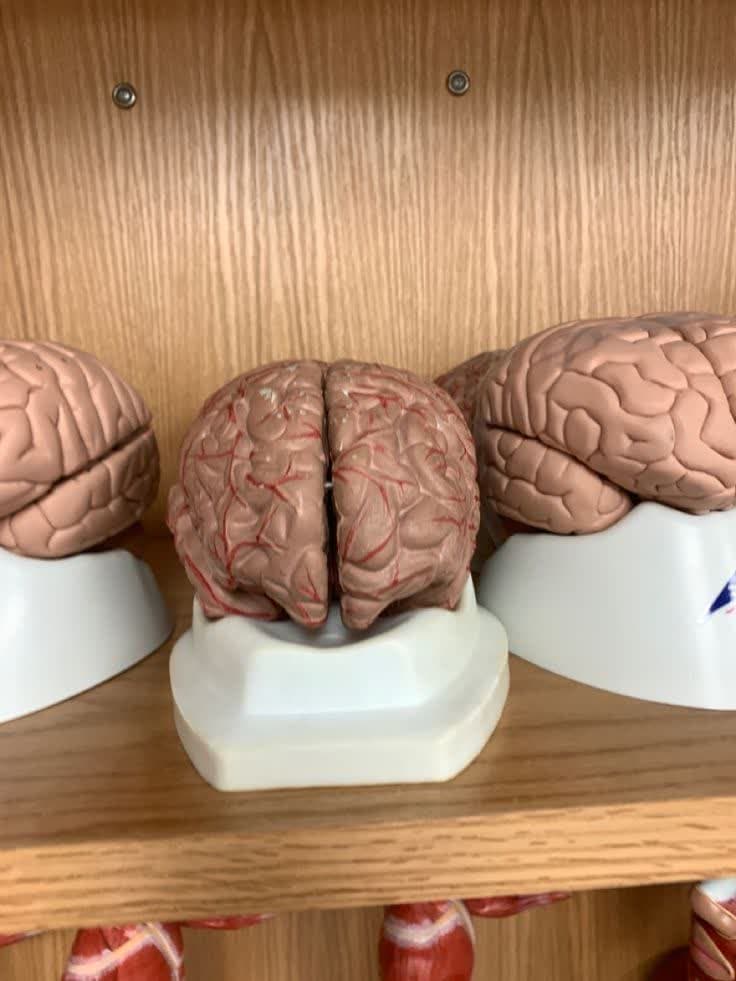 تعریف تومور مغزی + معرفی بهترین متخصص مغز و اعصاب 2023