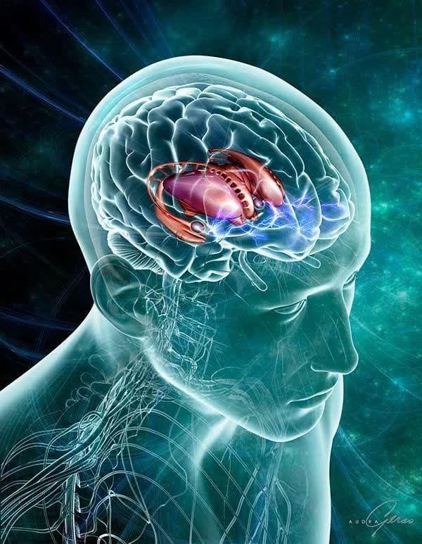 تعریف تومور مغزی + معرفی بهترین متخصص مغز و اعصاب 2023