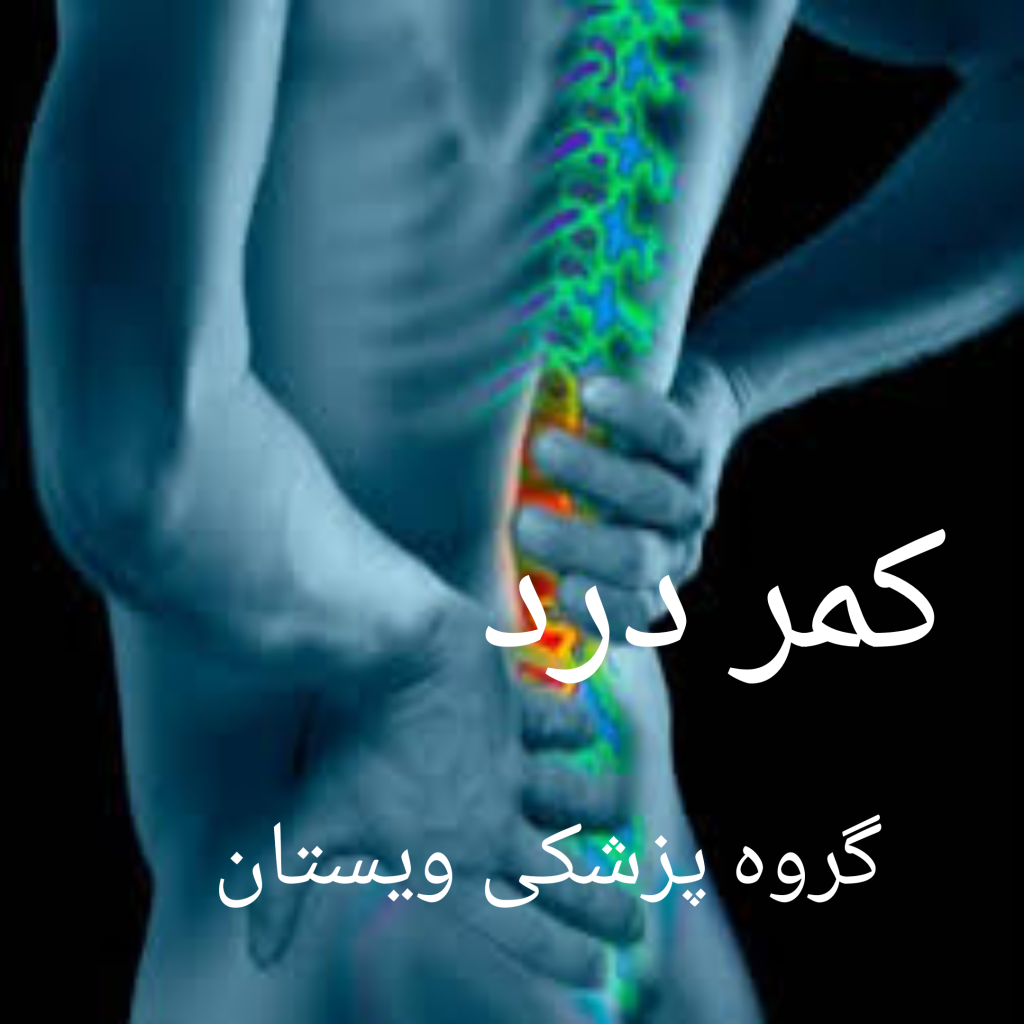 انواع کمر درد
