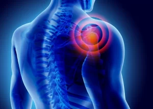 درد آرتروز گردن ممکن است به به دست برسد