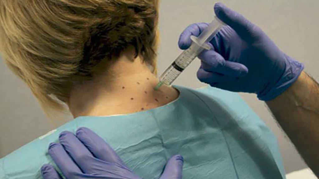 درمان دیسک گردن با ازون تراپی ازون تراپی گردن