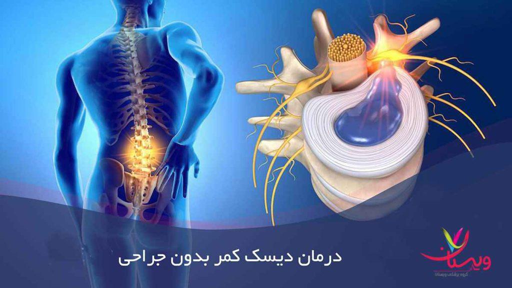 ورزش برای درمان دیسک کمر درمان دیسک کمر با ورزش