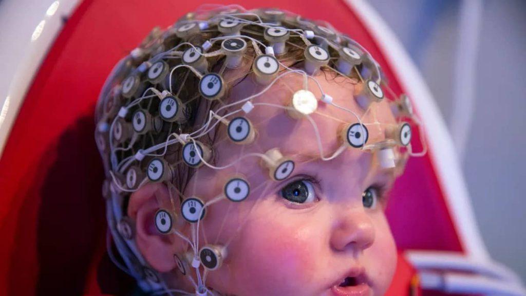 EEG of hyperacive kids