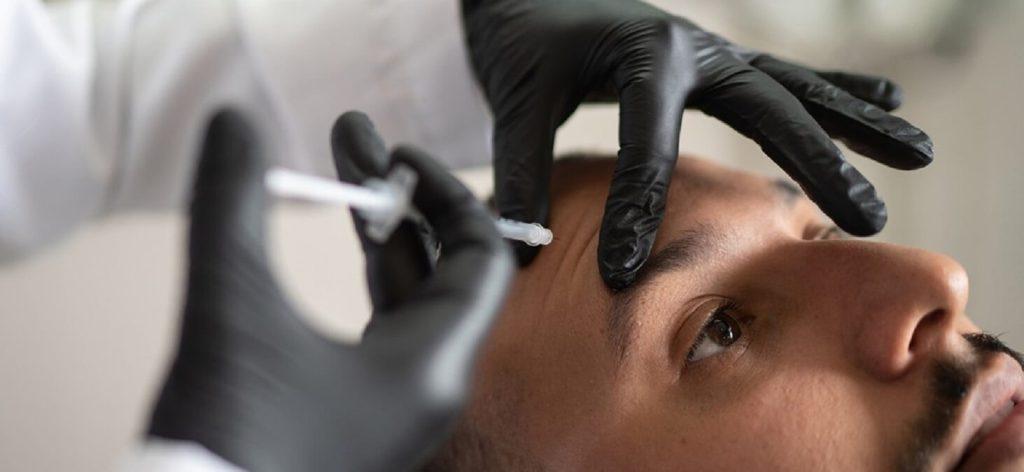 بوتاکس میگرن برای آقایان