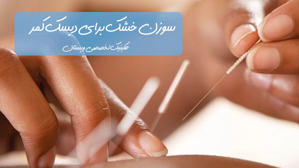 پزشک در حال انجام طب سوزنی روی بیمار