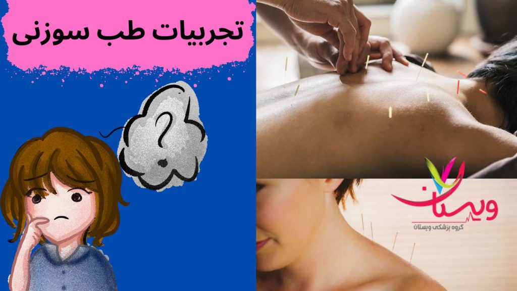 بهترین زمان برای طب سوزنی تجربیات طب سوزنی