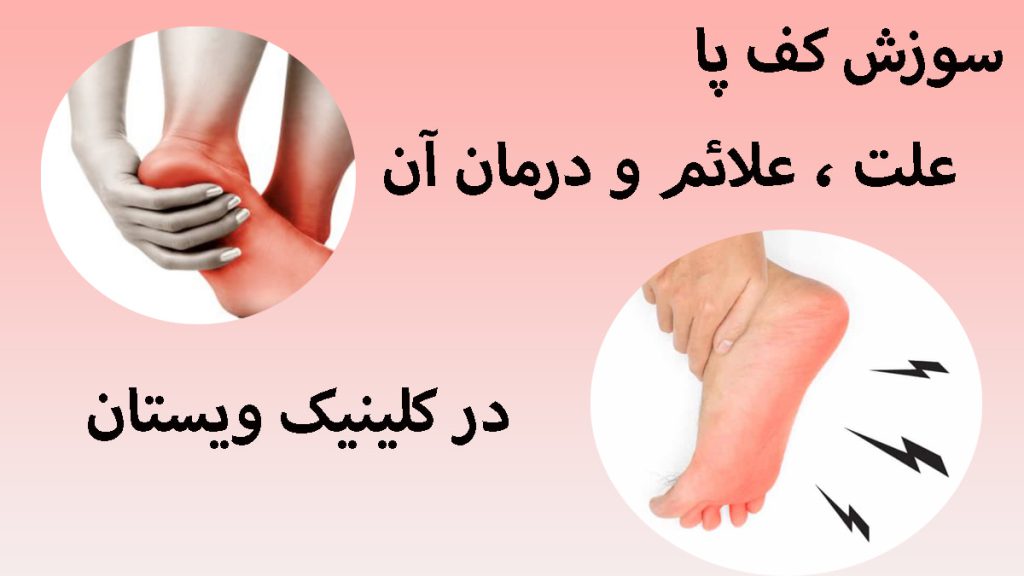 دو تصویر از سوزش پا