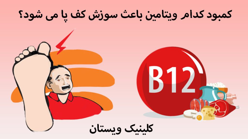 کمبود ویتامین و سوزش کف پا تصویر انیمیشنی از کف پای شخص و چند ماده غذایی حاوی ویتامین