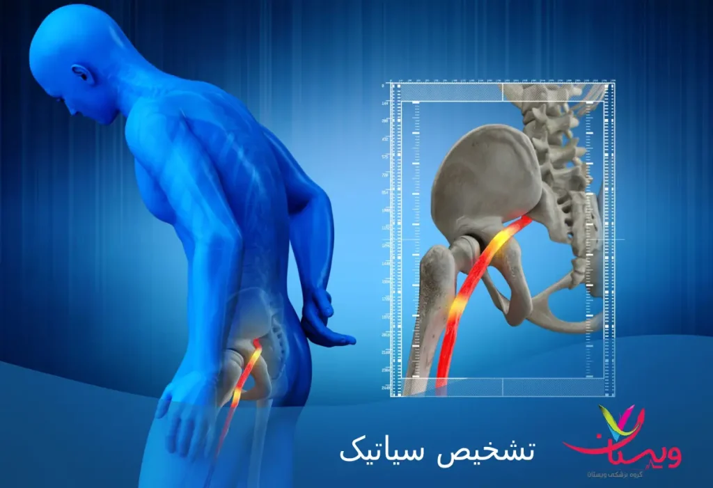 بدن انسان با درد در پشت